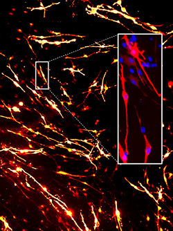 Rodent neural stem cells genetically engineered using nanoparticles functionalised with minicircle DNA vectors, photo Alinda Fernande